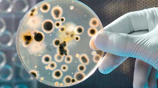 tuberculoza multirezistenta intr un an o persoana cu tbc care nu stie ca este bolnava transmite infectia altor 10 15