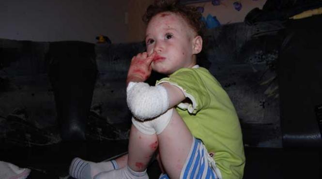 impreuna salvam vieti alesiei maria truica i s a redat vederea cu ajutorul dvs in campania vreau sa ajut