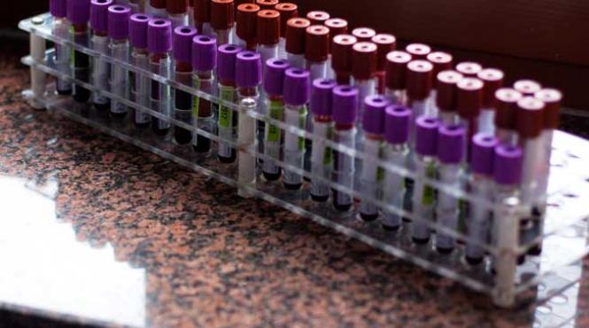 o noua terapie prin care leucemia poate fi invinsa reprogramarea limfocitelor pentru a tinti celule maligne