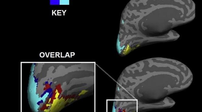 medicii uluiti ce au descoperit neurologii americani la un barbat i a fascinat de a dreptul