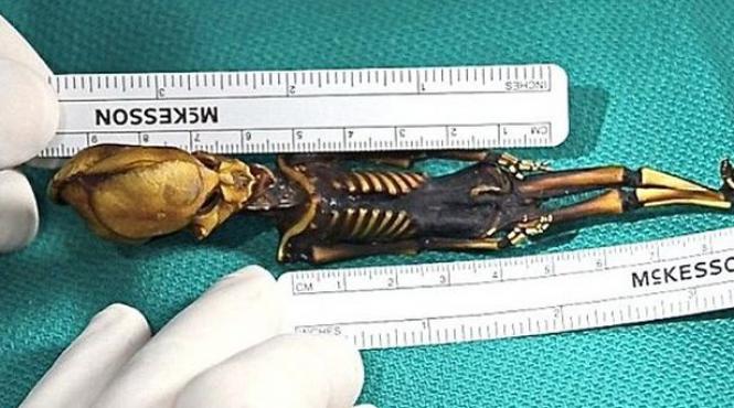 umanoidul din atacama fat avortat