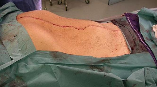 am ramas socat cand am auzit verdictul ce au descoperit medicii in abdomenul unui barbat