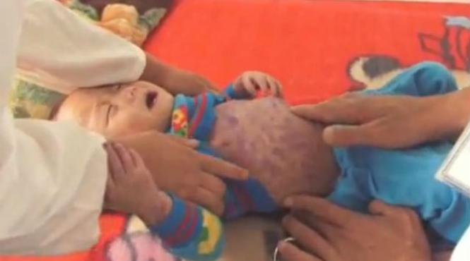 onu aproba un ajutor alimentar in valoare de 200 milioane de dolari pentru coreea de nord