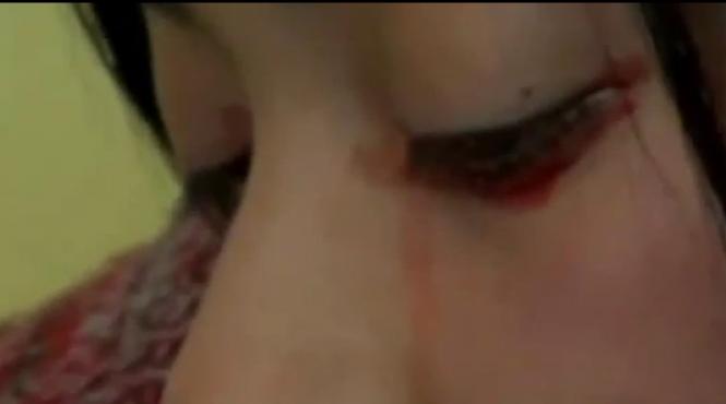 medicii nu au putere in fata acestei boli o tanara plange cu lacrimi de sange video