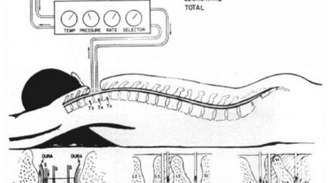 transplant de cap proiect gemini sergio canavaro