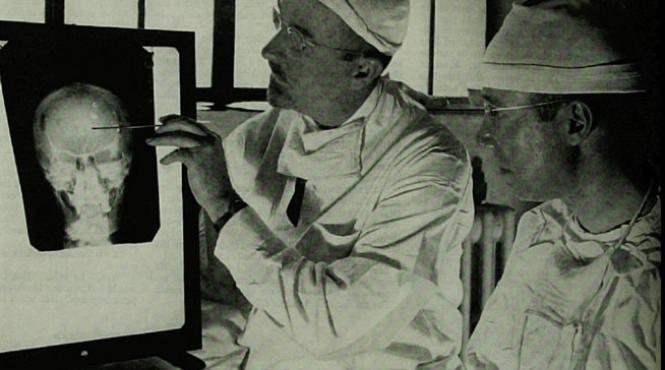 practici bizare de a lungul istoriei cum erau tratati pacientii cand operatiile se faceau fara anestezie