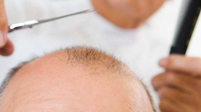 un tratament contra calvitiei