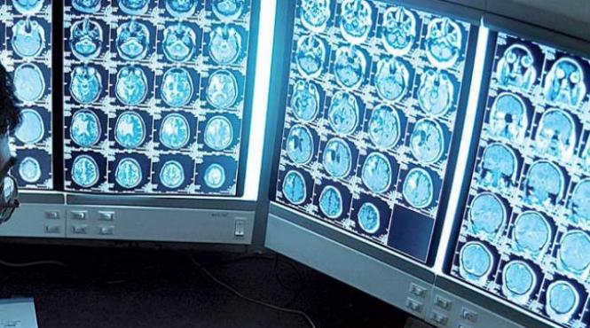 la institutul clinic fundeni aparatura performanta pentru diagnosticarea preococe si monitorizarea cancerului