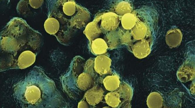 bacteriile bat antibioticele