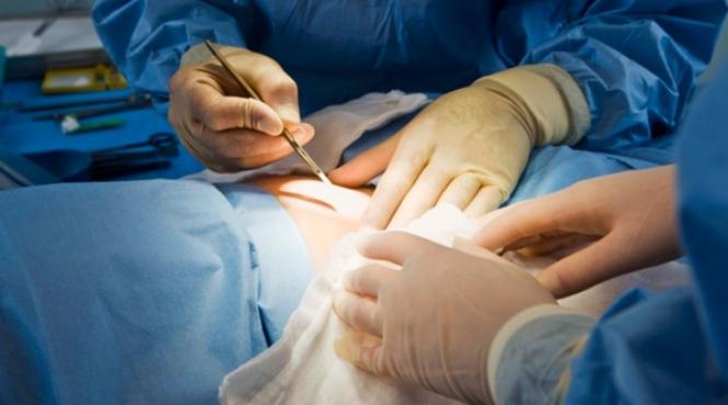 opera ia de cezariana la cerere nu e inclusa in pachetul de servicii medicale de baza