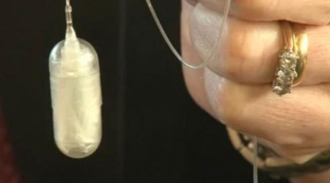 balon stomac obezitate