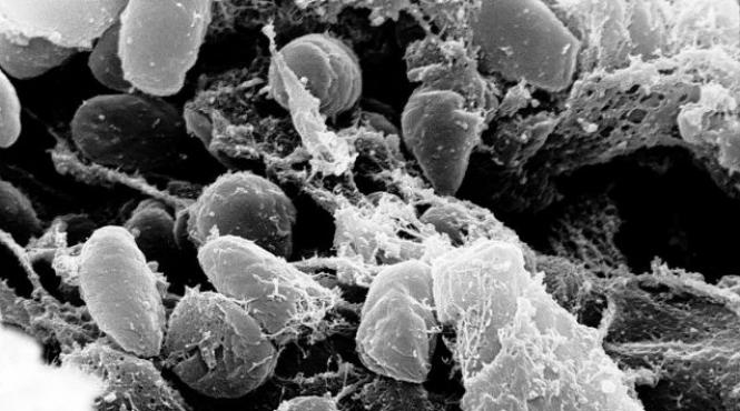 ciuma iustinian moartea neagra yersinia pestis