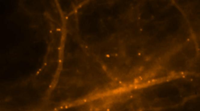 descoperire fascinanta in lumea stiintei ce au filmat in premiera in creier specialis tii de la o universitate din sua video