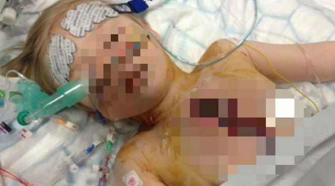 imagini cu puternic impact emotional baietel de 3 ani operat pe inima si lasat cu pieptul deschis timp de 5 zile video