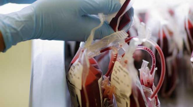 sangele tanar elixir pentru creierul batran transfuzia de plasma amelioreaza tinerea de minte si previne amenzia