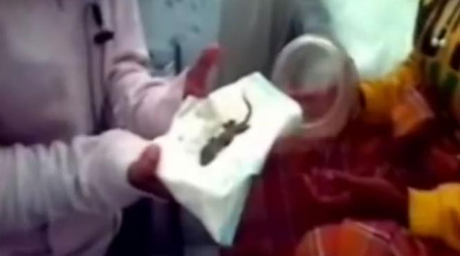 femeie nastere soparla sarcina falsa