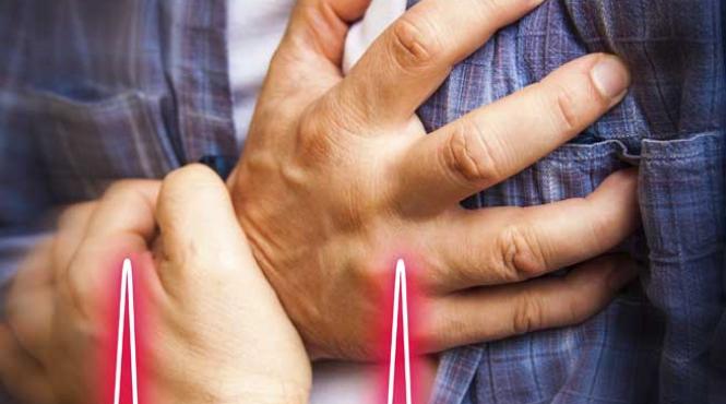 angioplastie si defibrilatoare pentru cardiaci