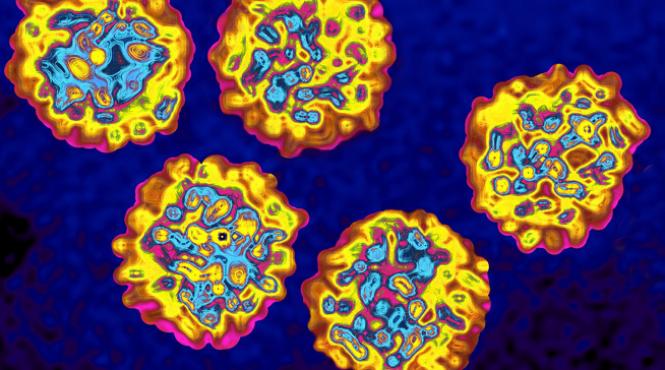 virusul hepatitic c scos din circulatie cu un program national si cu noile molecule e posibila reducerea numarului cazurilor de ciroza si cancer hepatic