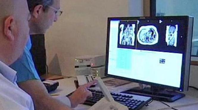 ce se intampla in creier dupa moarte descoperire incredibila facuta de medici romani si canadieni video