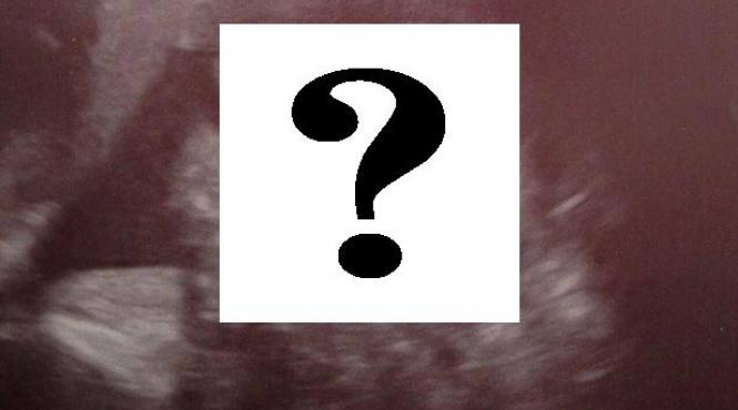 ecografie evolutie sarcina medic fatul