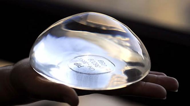 implant mamar cu risc de cancer 18 femei cu proteze mamare au dezvoltat o forma rara de cancer