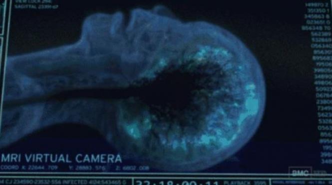 o noua descoperire contrazice orice practica medicala de urgenta ce se intampla in creier in momentele dinaintea mortii