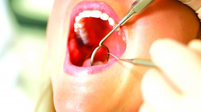 implantul dentar mituri explicate de un specialist
