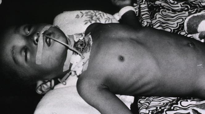 un copil risca sa moara pentru ca parintii au decis sa nu il vaccineze