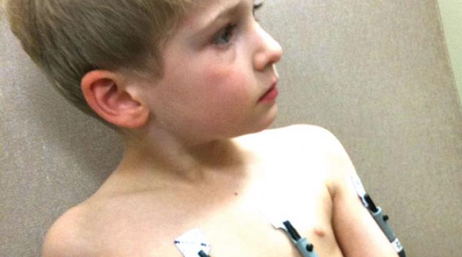 electrocardiograme gratuite pentru copii