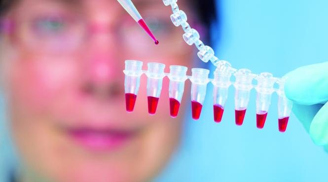 fara strategie hiv sida de mai bine de opt ani