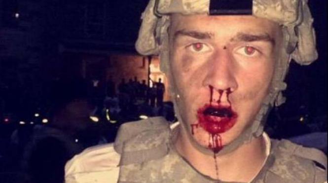 o bataie cu perne a devenit o baie de sange 30 de oameni au fost raniti