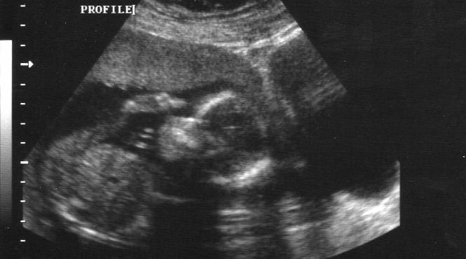 vesti alarmante de ce umanitatea risca sa nu se mai poata reproduce