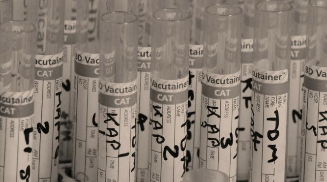 romanii se pot testa gratuit pentru hiv si virusurile hepatice b si c