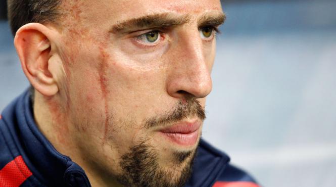 frank ribery da in judecata cnn si cere despagubiri in valoare de 1 5 milioane de dolari