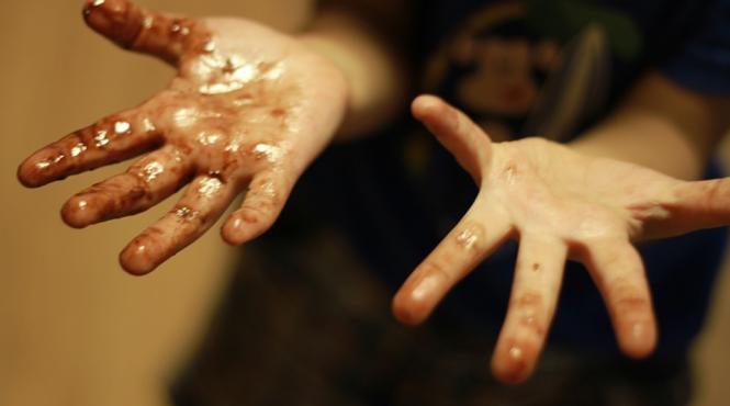 ce boli poti lua daca ai mainile murdare