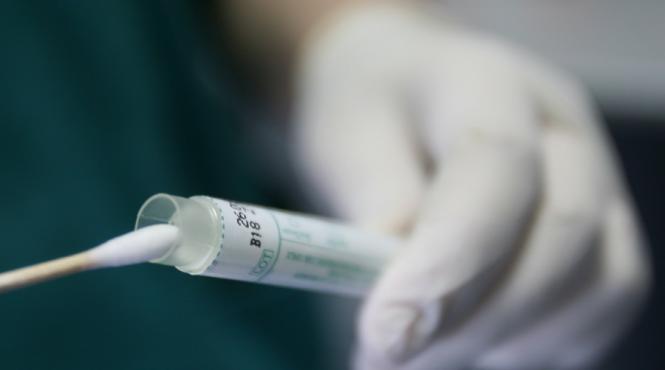 ms extinde prelevarea testelor de sanitatie privind utilizarea dezinfectantilor recoltarea prin controale incrucisate