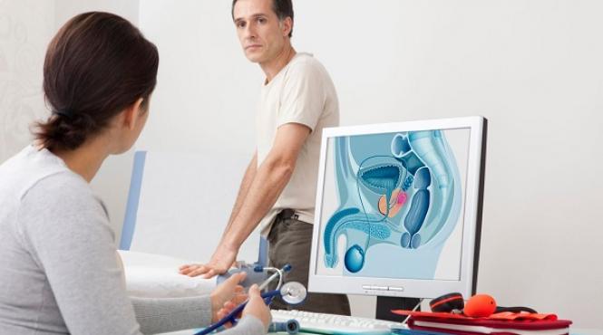 tratamente naturiste totul despre afectiunile prostatei terapii alternative in caz de noduli sau cancer