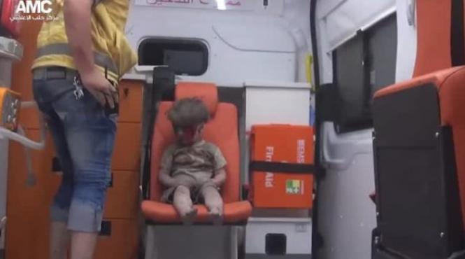 fratele micutului omran ar fi murit intr un spital din alep din cauza ranilor