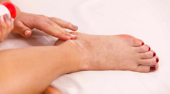 sfatul medicului cum tratam rapid entorsele