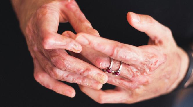 drama din colectiv alexandra furnea supravietuitoare flacara aceea pustiitoare mi a rapit ani din viata si mi a ucis prietenii