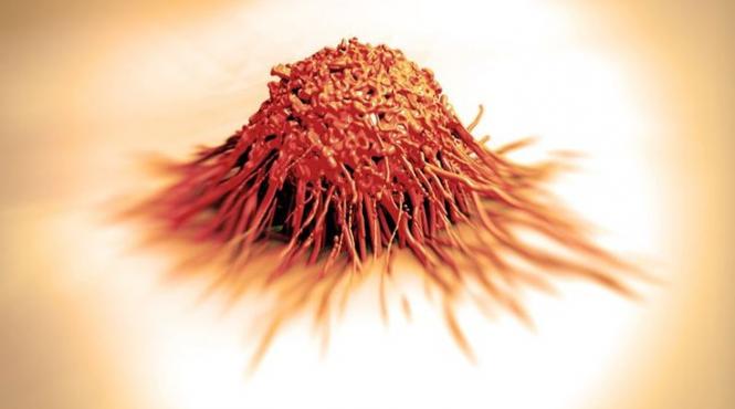 tratamente naturiste lupta cu cancerul previne infarctul si arteroscleroza afla ingredientele secrete