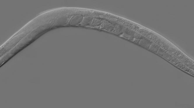 o gena care ar putea combate obezitatea descoperita la un vierme studiu