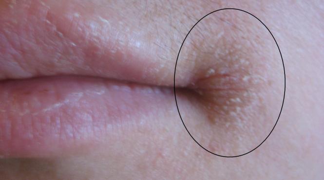 va confruntati cu aceasta problema iata ce afectiuni grave ar putea indica