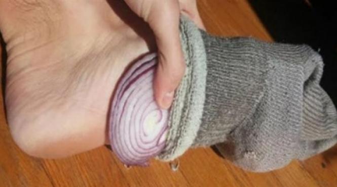 tratamente naturiste e incredibil ce se intampla daca pui ceapa in sosete inainte de culcare