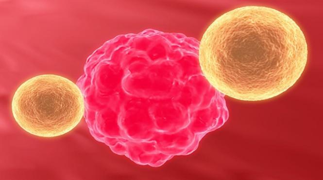 cancerul pancreatic tot ce trebuie sa stii cauze simptome tratament