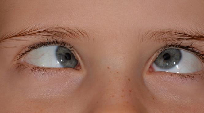 cum scapam ieftin de punctele negre