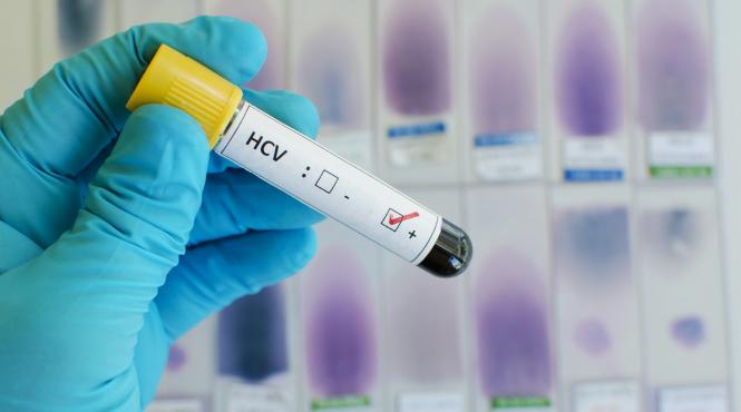 romania in topul deceselor cauzate de hepatita