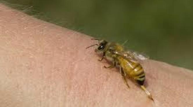 alerta in harghita numarul cazurilor de intepaturi de viespi si albine a crescut semnificativ unii pacienti vin in soc anafilactic la spital