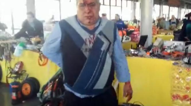 un barbat a fost batut crunt si lovit cu un topor de 10 indivizi intr o piata aglomerata din lugoj