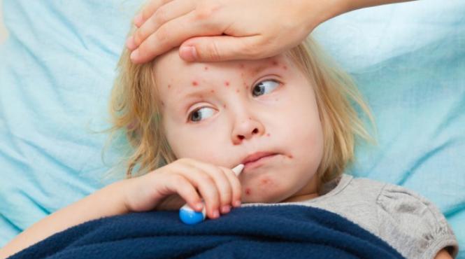 numarul cazurilor de rujeola a ajuns la 10 423